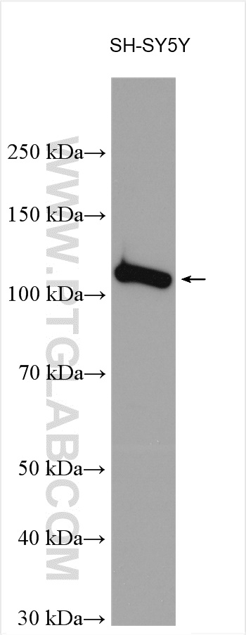 WB analysis using 24931-1-AP