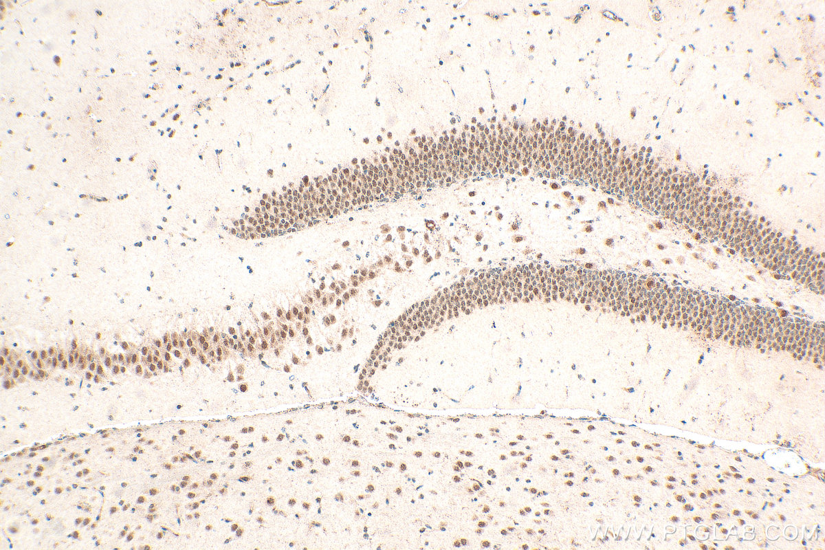 Immunohistochemical analysis of paraffin-embedded mouse brain tissue slide using 21952-1-AP (NCOA1/SRC-1 antibody) at dilution of 1:400 (under 10x lens). Heat mediated antigen retrieval with Tris-EDTA buffer (pH 9.0). IHC staining of mouse brain using 21952-1-AP