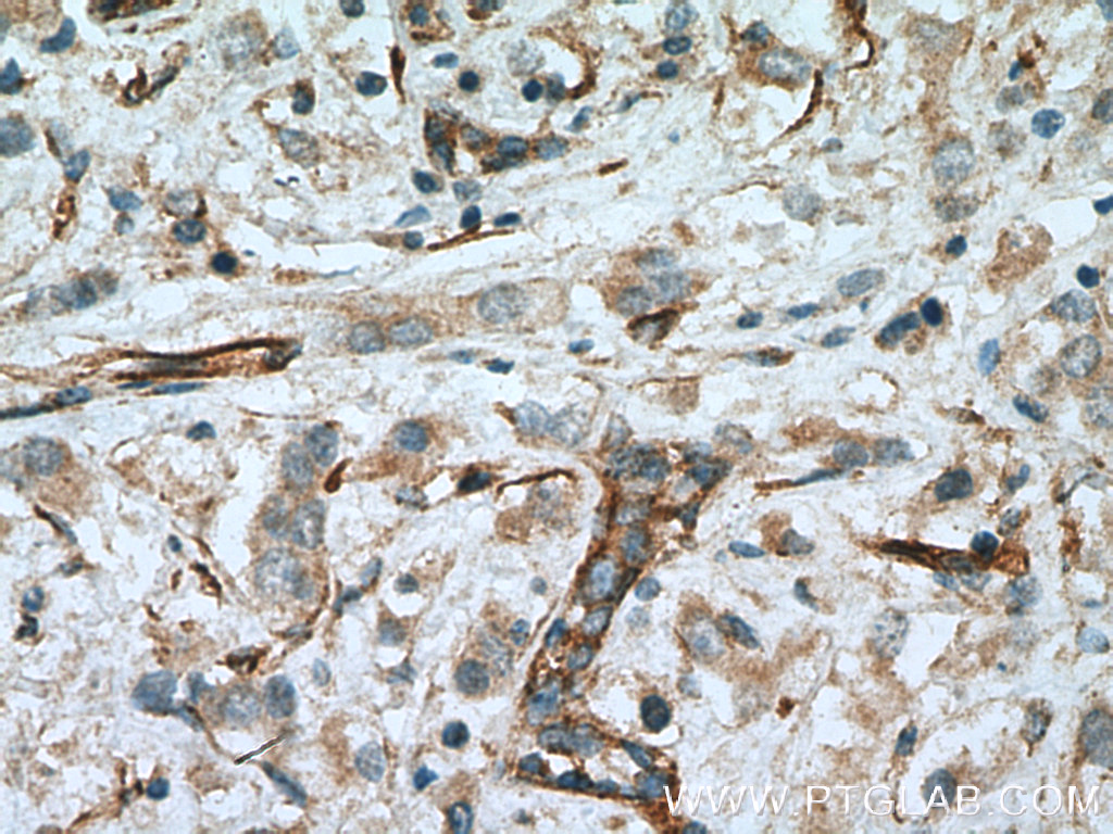 c-SRC Polyclonal antibody