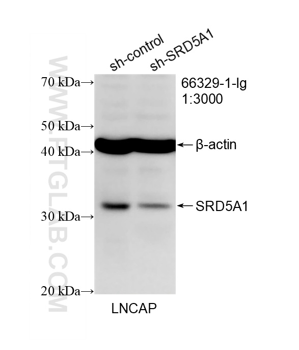 WB result of SRD5A1 antibody (<a class='green' href='/productredirect?CatalogNo=66329-1-Ig' target='_blank'>66329-1-Ig</a>; 1:3000; incubated at room temperature for 1.5 hours) with sh-Control and sh-SRD5A1 transfected LNCaP cells. This data was developed using the same antibody clone with 66329-1-PBS in a different storage buffer formulation. WB analysis of LNCaP using 66329-1-Ig (same clone as 66329-1-PBS)