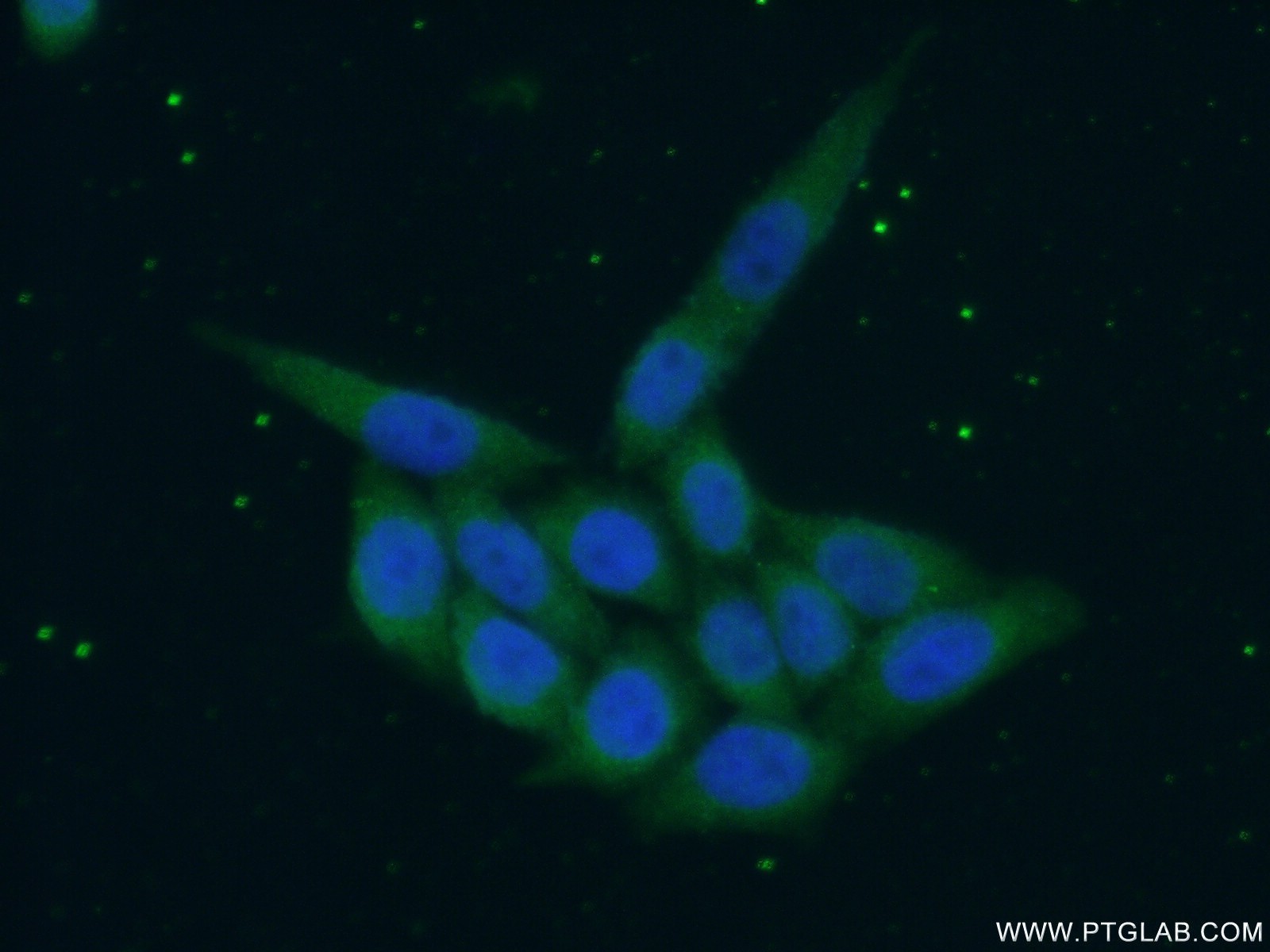 IF Staining of HeLa using 14088-1-AP