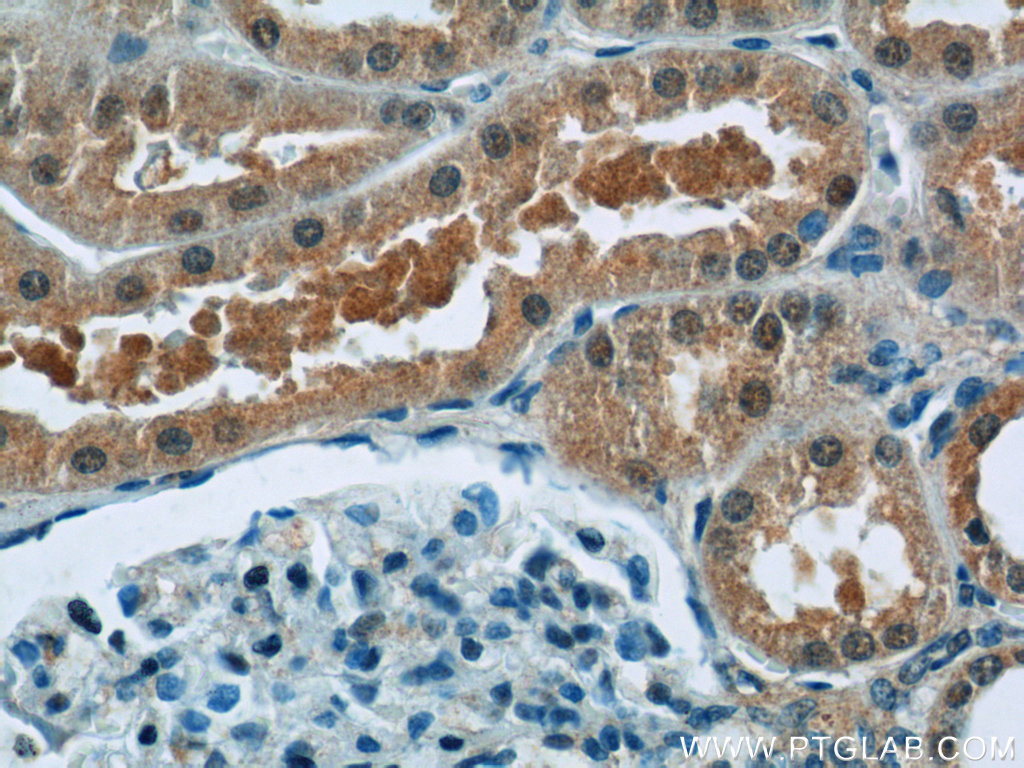 IHC staining of human kidney using 14088-1-AP