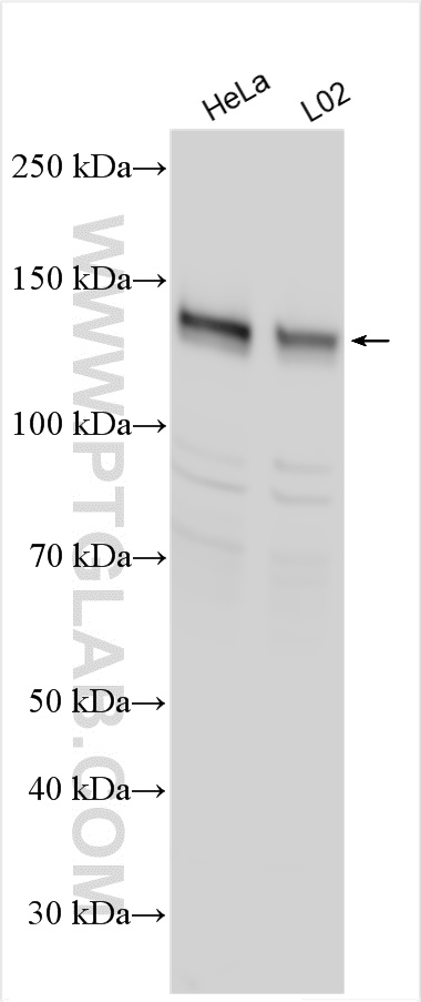 WB analysis using 14088-1-AP