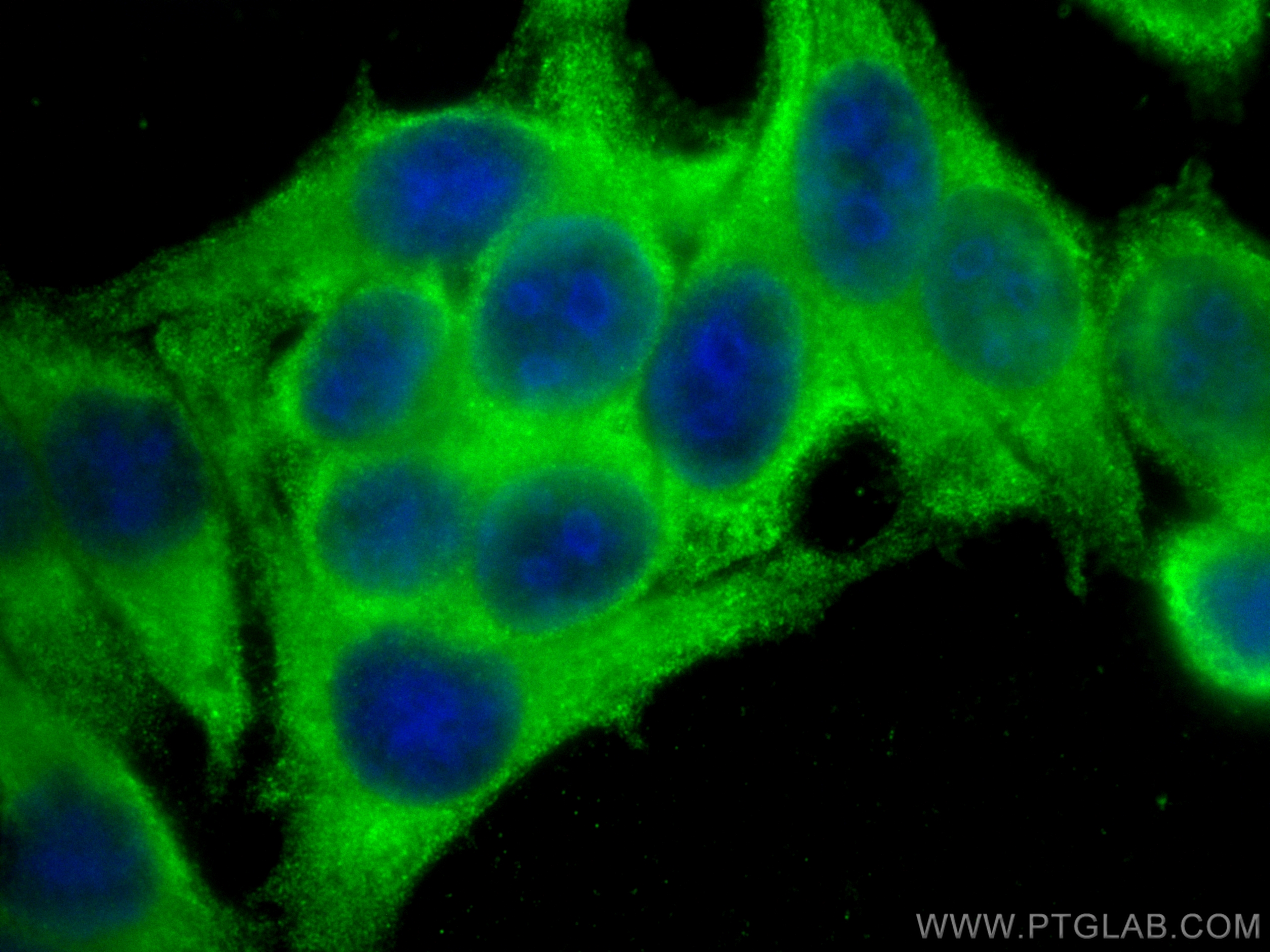 IF Staining of HepG2 using 66875-1-Ig