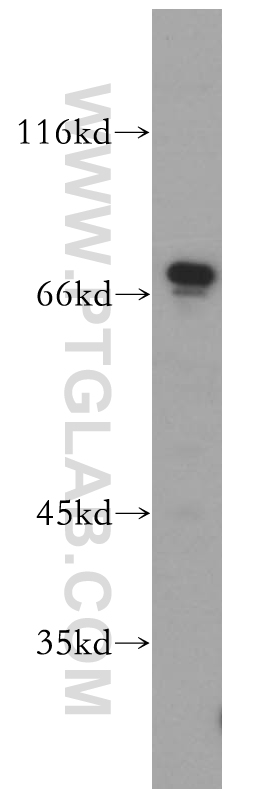 SREBF2 Polyclonal antibody