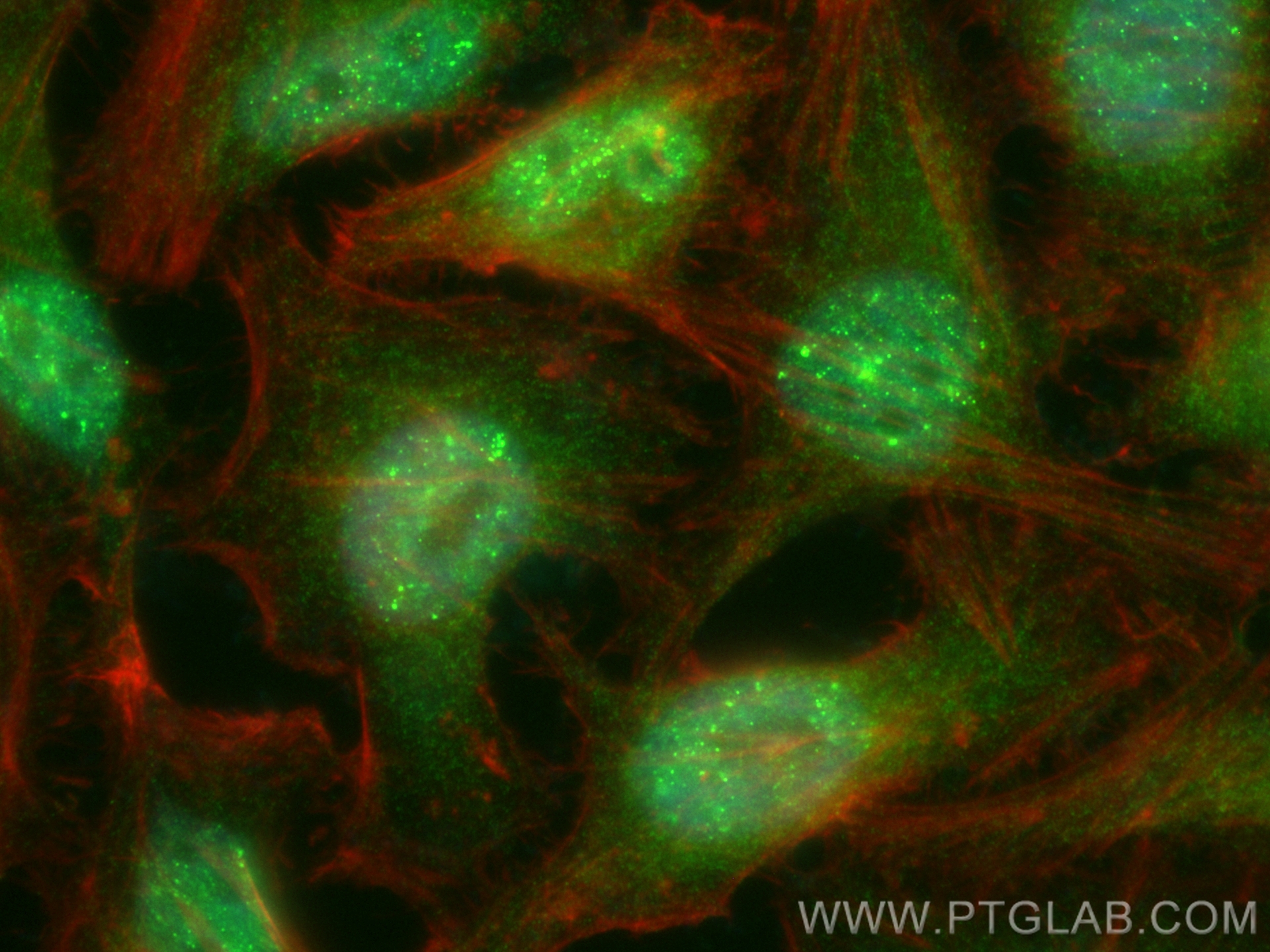 IF Staining of HeLa using CL488-83403