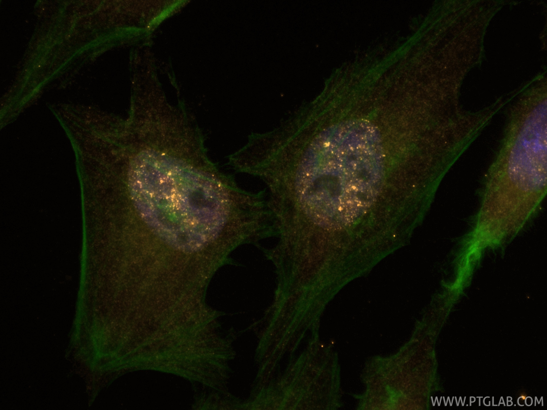 IF Staining of HeLa using CL555-83403