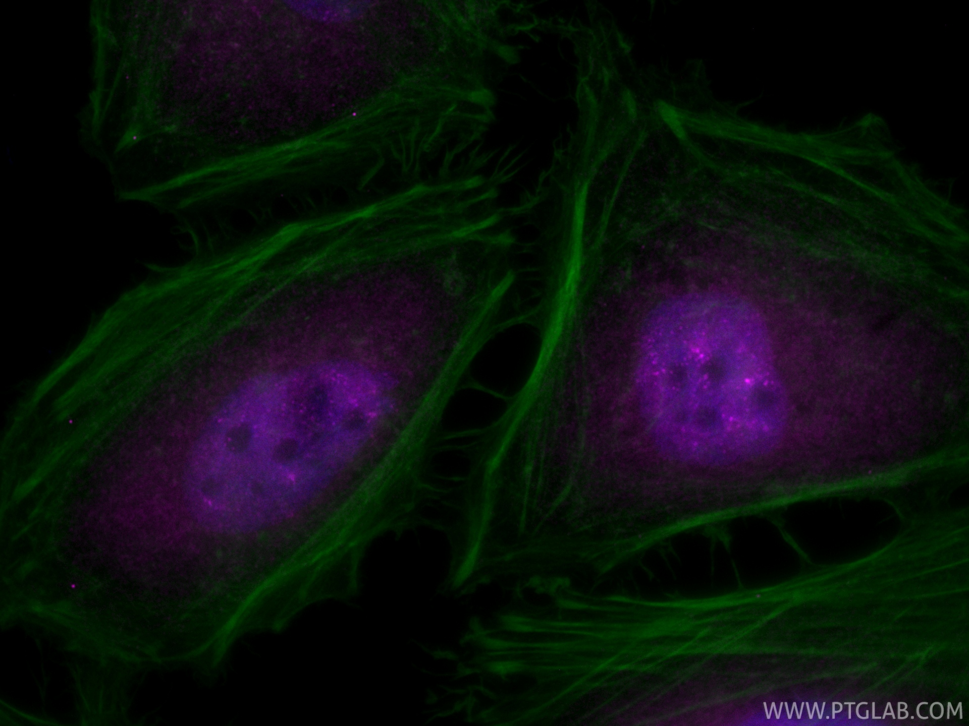 IF Staining of HeLa using CL647-83403
