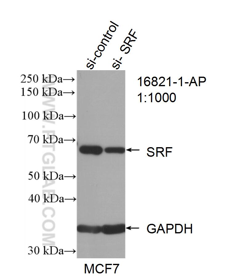 WB analysis of MCF-7 using 16821-1-AP