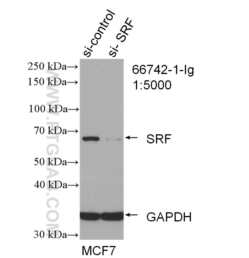 WB analysis of MCF-7 using 66742-1-Ig