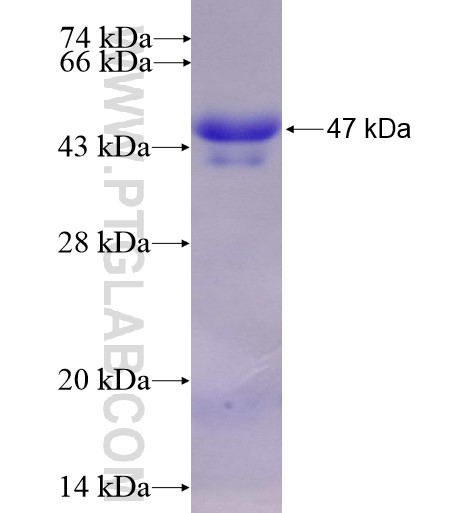 SRF fusion protein Ag10386 SDS-PAGE