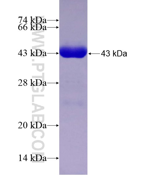 SRGAP3 fusion protein Ag28571 SDS-PAGE SRGAP3 fusion protein Ag28571 SDS-PAGE