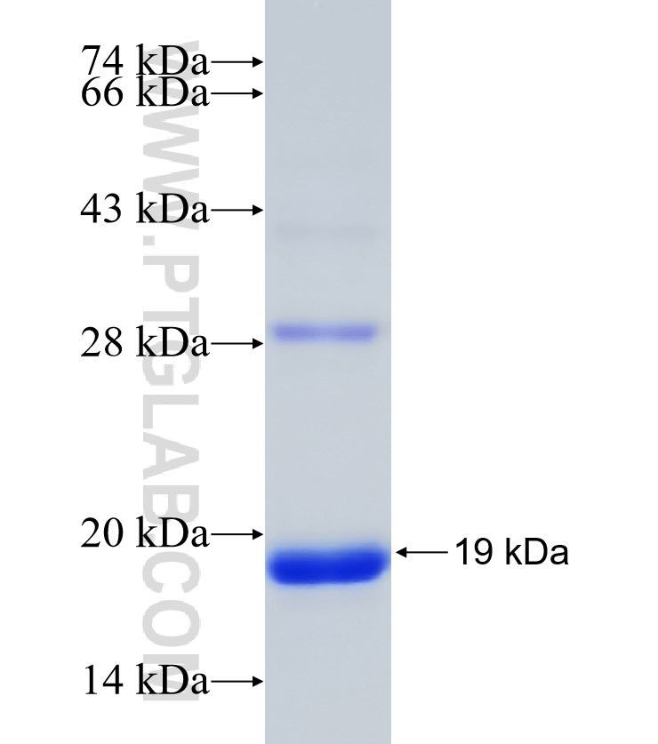 SRGAP3 fusion protein Ag31205 SDS-PAGE
