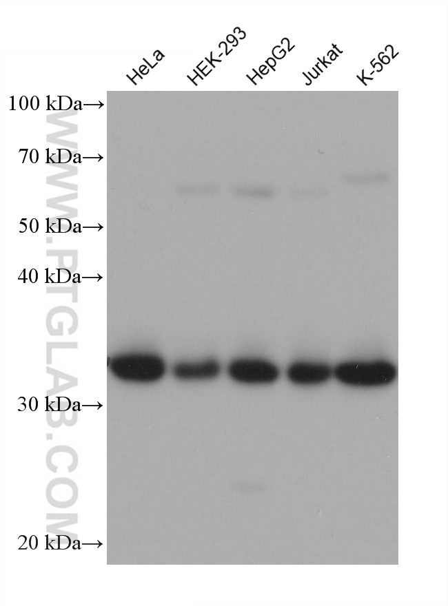 WB analysis using 68548-1-Ig