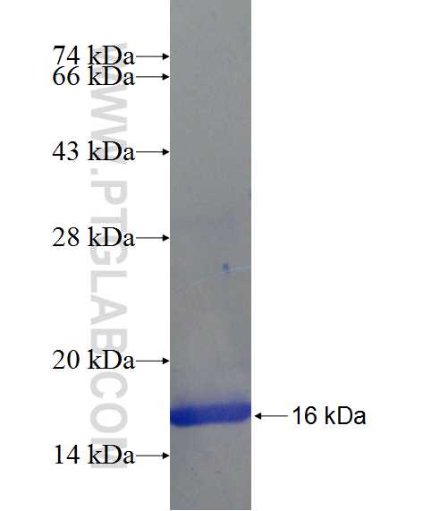 SRMS fusion protein Ag24448 SDS-PAGE SRMS fusion protein Ag24448 SDS-PAGE