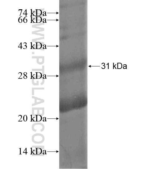 SRMS fusion protein Ag20330 SDS-PAGE SRMS fusion protein Ag20330 SDS-PAGE
