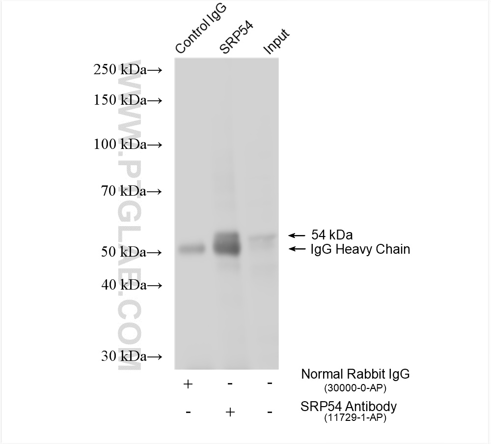 IP experiment of human placenta using 11729-1-AP