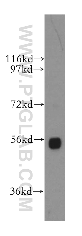 WB analysis of human placenta using 11729-1-AP