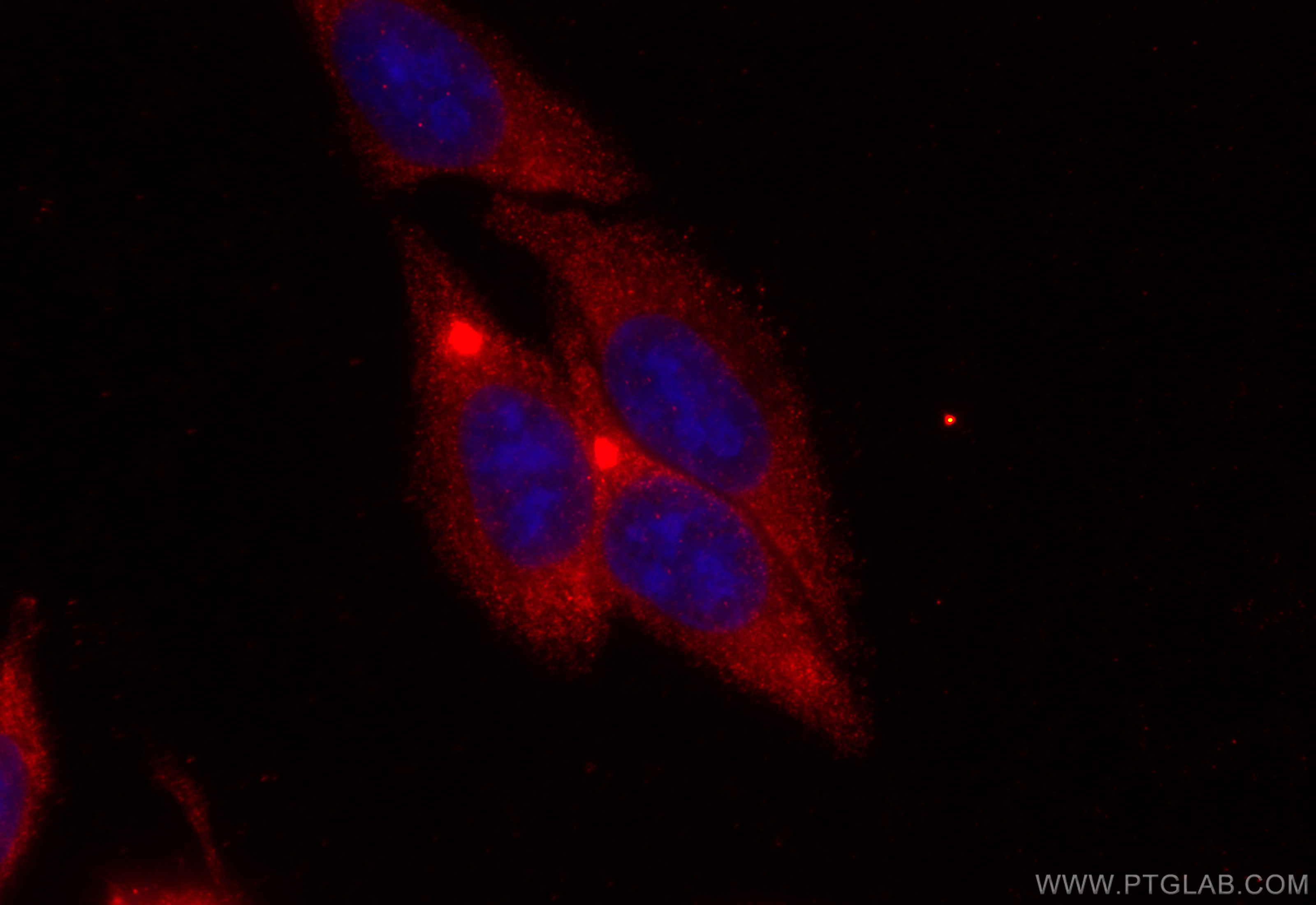 IF Staining of HepG2 using 17976-1-AP