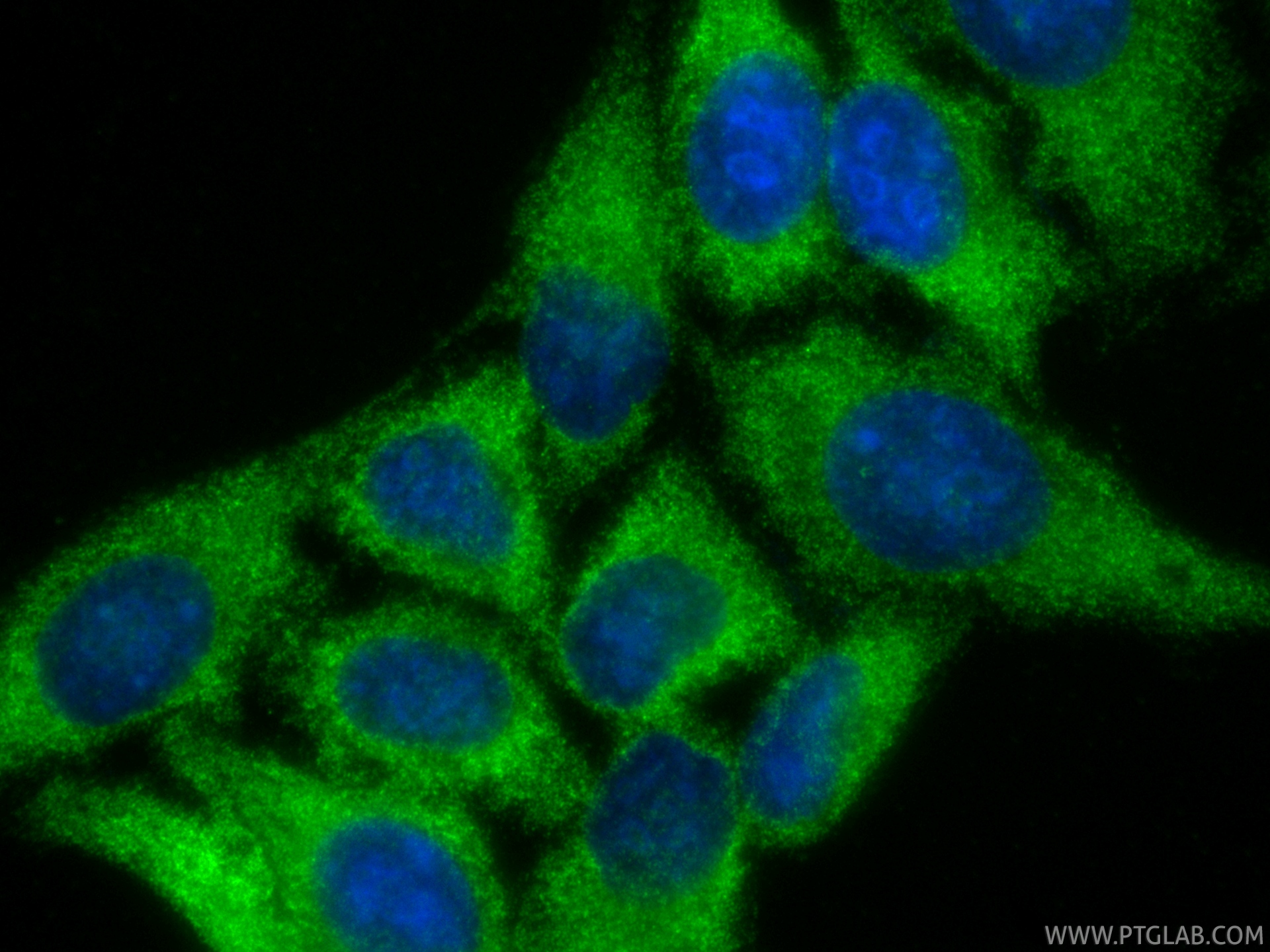 Immunofluorescent analysis of (-20°C Ethanol) fixed HepG2 cells using SRP54 antibody (<a class='green' href='/productredirect?CatalogNo=84014-6-RR' target='_blank'>84014-6-RR</a>, Clone: 241125G1 ) at dilution of 1:400 and CoraLite®488-Conjugated Goat Anti-Rabbit IgG(H+L) (<a class='green' href='/productredirect?CatalogNo=SA00013-2' target='_blank'>SA00013-2</a>). This data was developed using the same antibody clone with 84014-6-PBS in a different storage buffer formulation. IF Staining of HepG2 using 84014-6-RR (same clone as 84014-6-PBS)