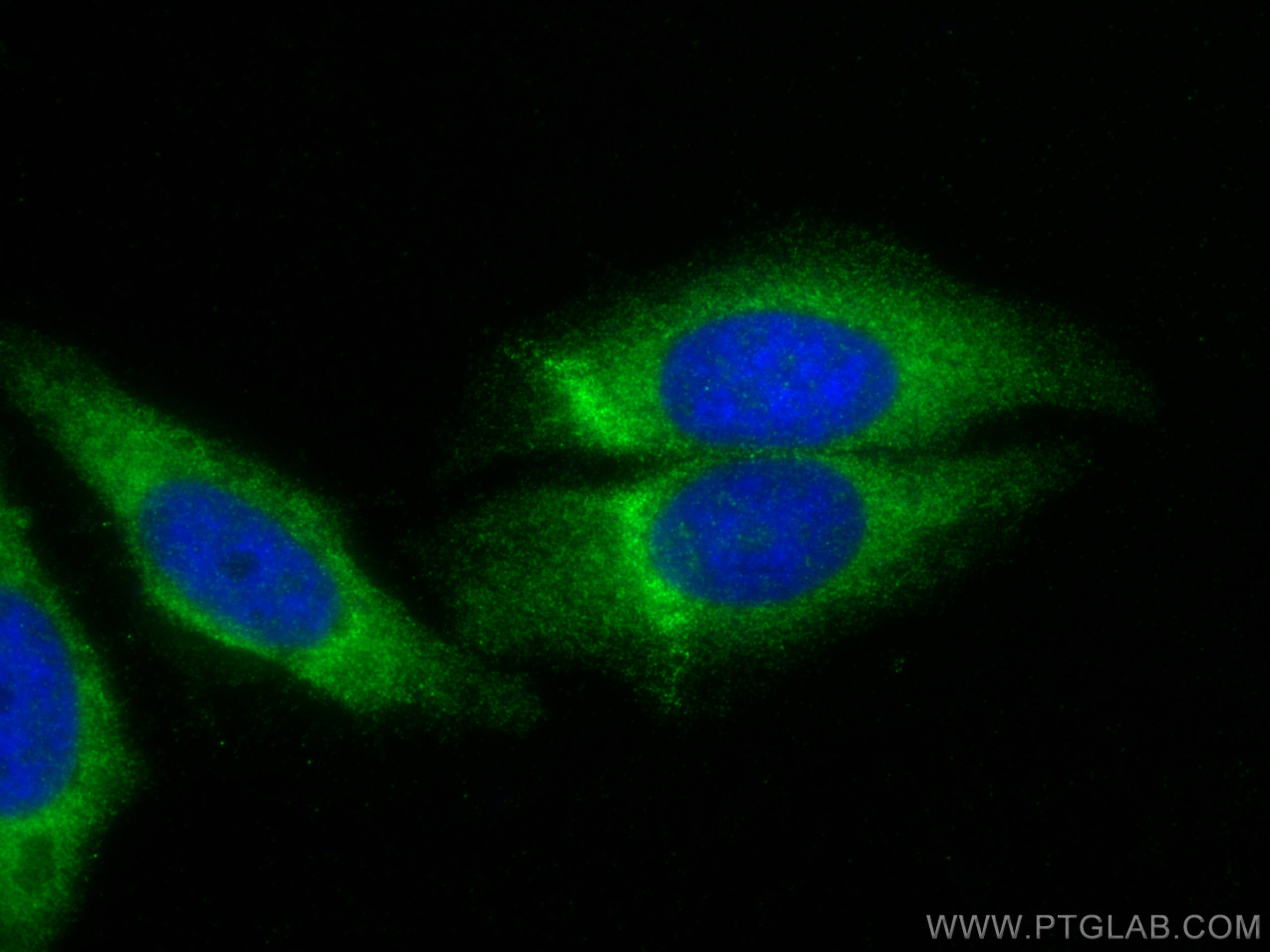 IF Staining of HepG2 using 11585-1-AP