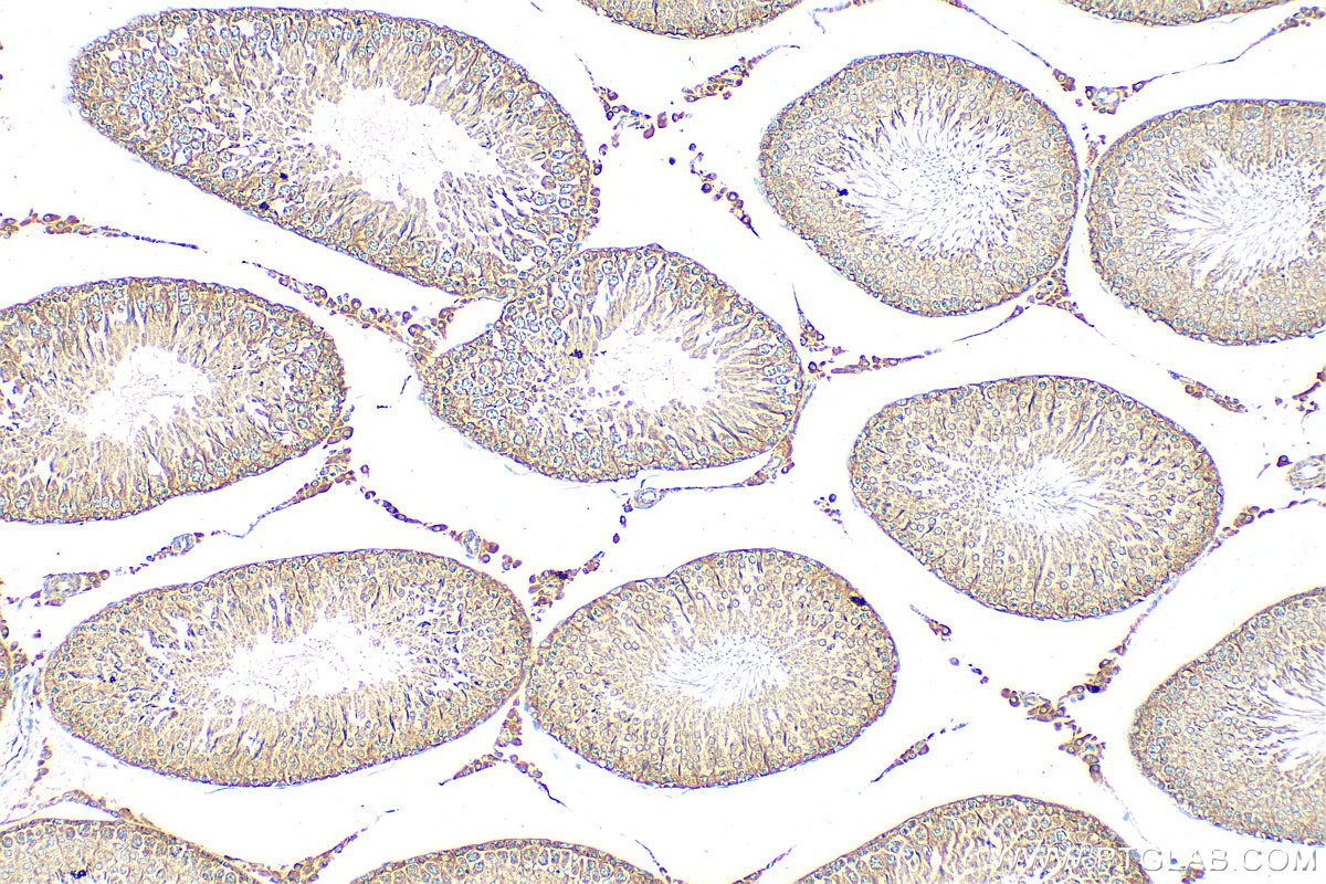 IHC staining of rat testis using 11585-1-AP