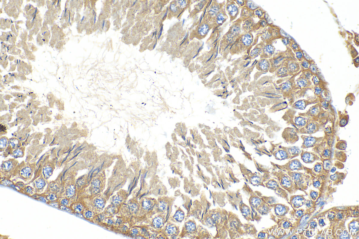 IHC staining of rat testis using 11585-1-AP