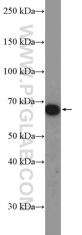 WB analysis of mouse brain using 11585-1-AP