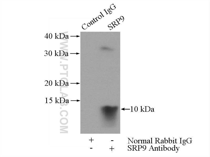 IP experiment of HepG2 using 11195-1-AP