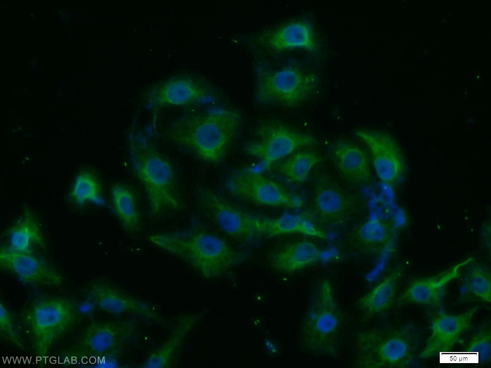 IF Staining of SH-SY5Y using 14073-1-AP