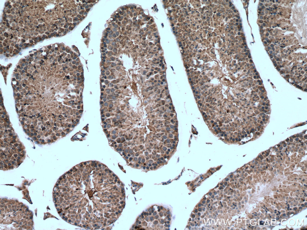 IHC staining of mouse testis using 25417-1-AP