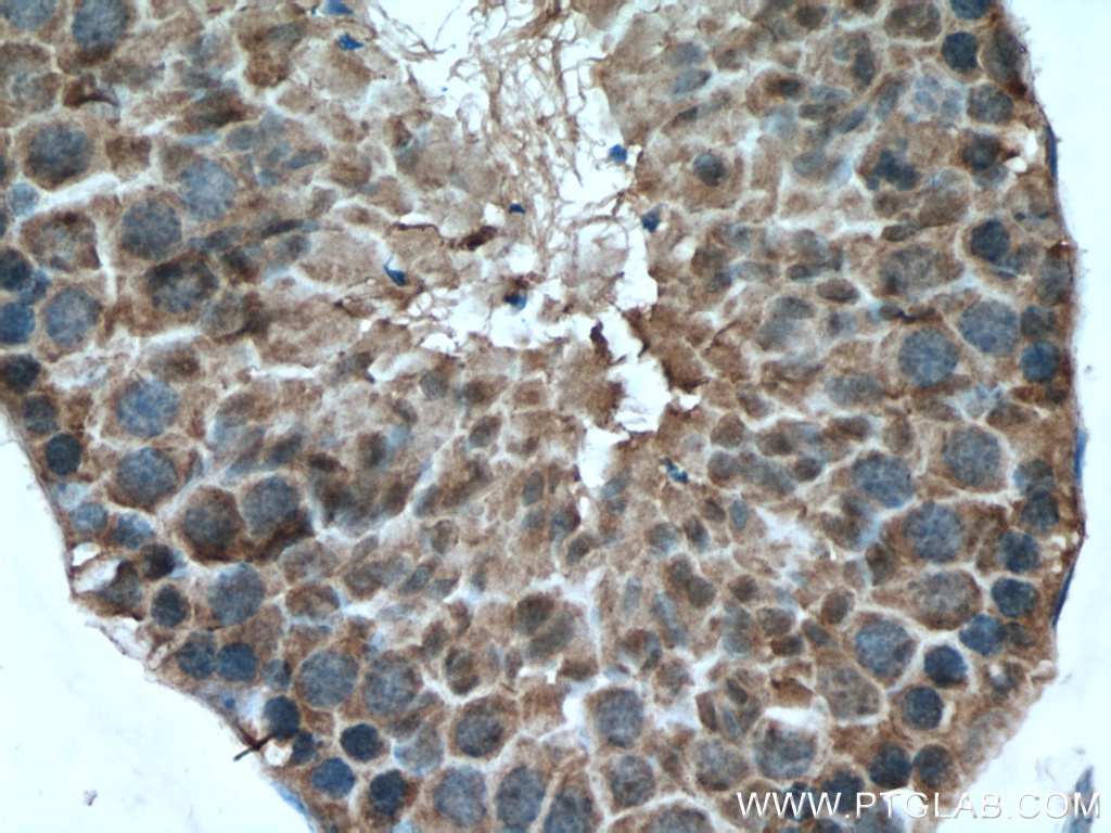 IHC staining of mouse testis using 25417-1-AP