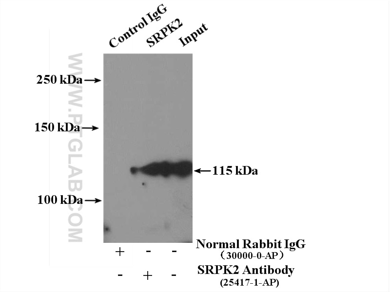 IP experiment of HeLa using 25417-1-AP