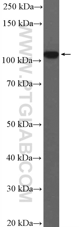 WB analysis of HeLa using 25417-1-AP