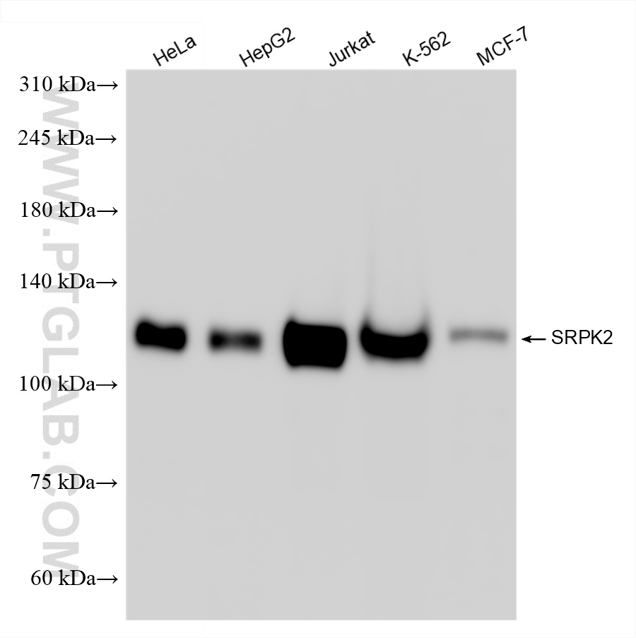 WB analysis using 85613-5-RR (same clone as 85613-5-PBS)
