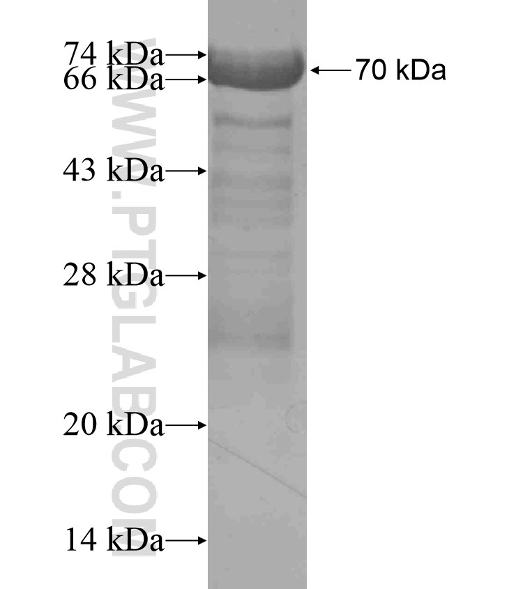 SRPK2 fusion protein Ag17885 SDS-PAGE