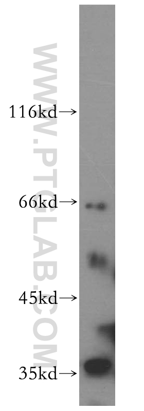 WB analysis of mouse liver using 12090-1-AP