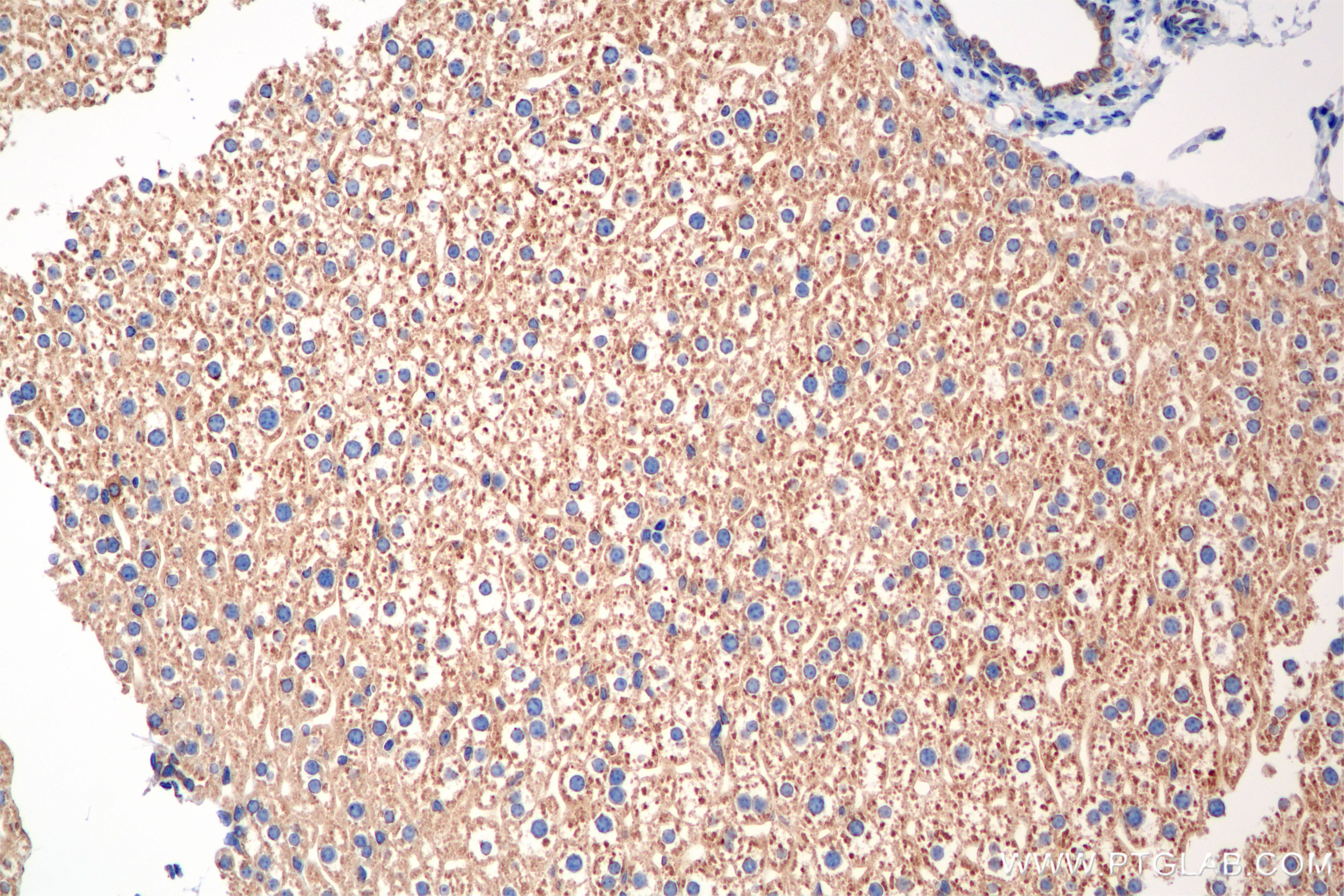 IHC staining of mouse liver using 85926-2-RR