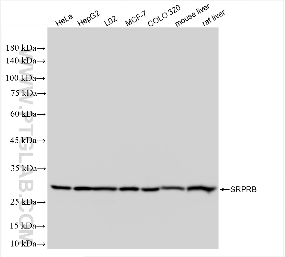 WB analysis using 85926-2-RR