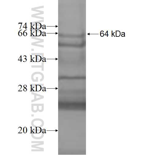 SRPX fusion protein Ag9559 SDS-PAGE SRPX fusion protein Ag9559 SDS-PAGE