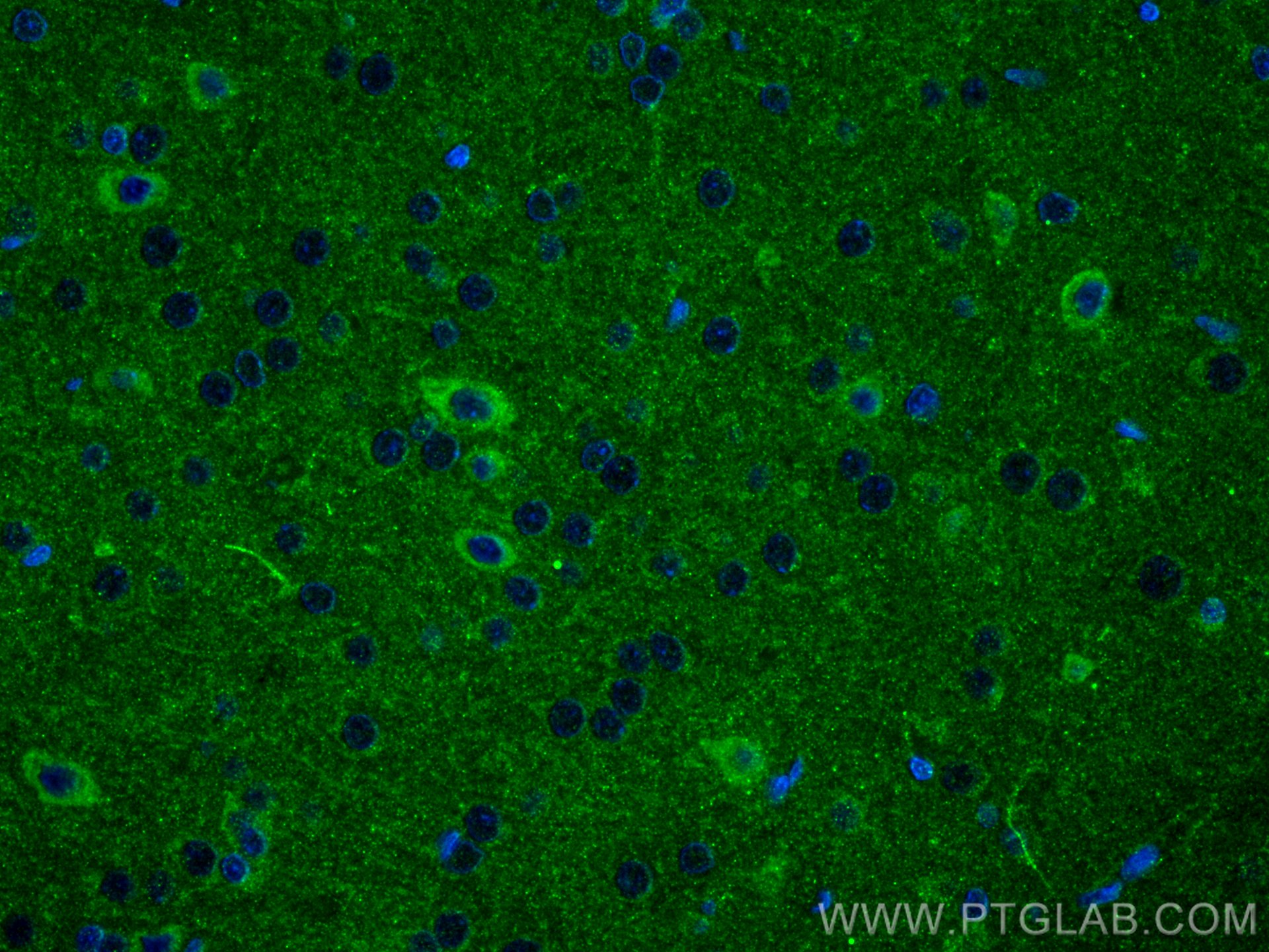 IF Staining of rat brain using 11845-1-AP