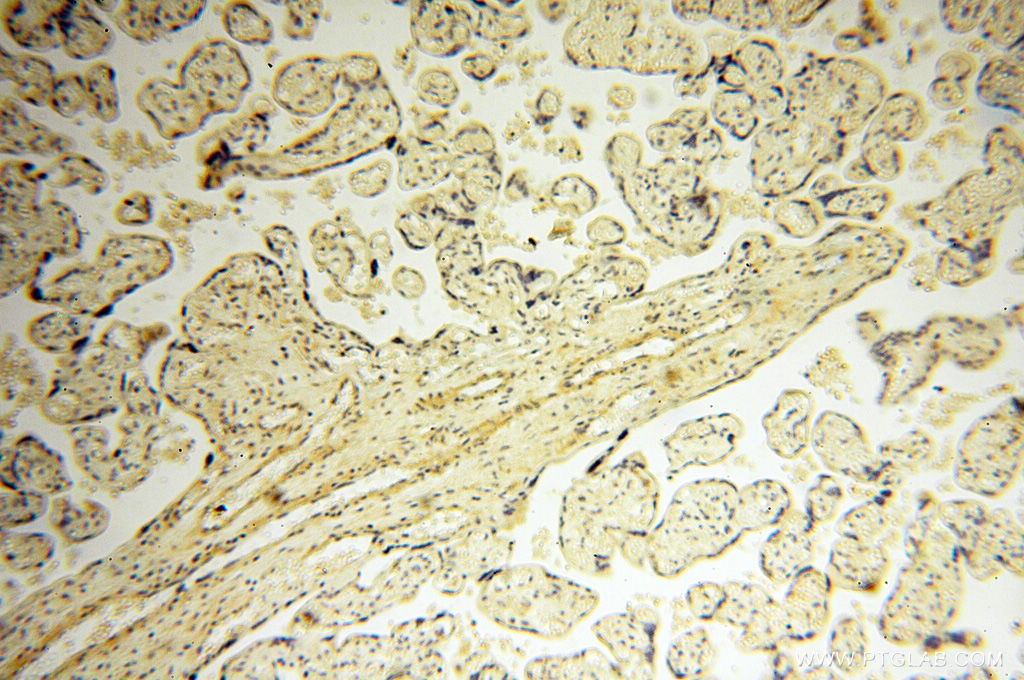 IHC staining of human placenta using 11845-1-AP