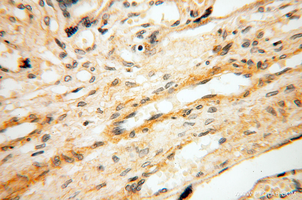 IHC staining of human placenta using 11845-1-AP