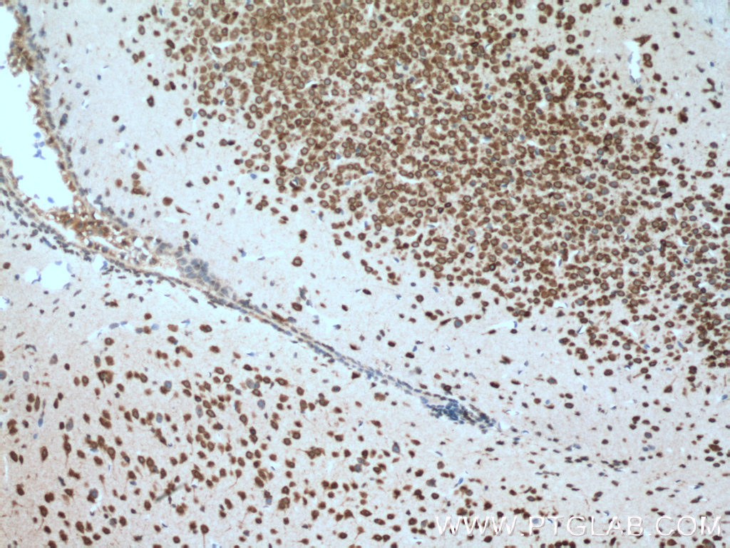 IHC staining of mouse brain using 66266-1-Ig