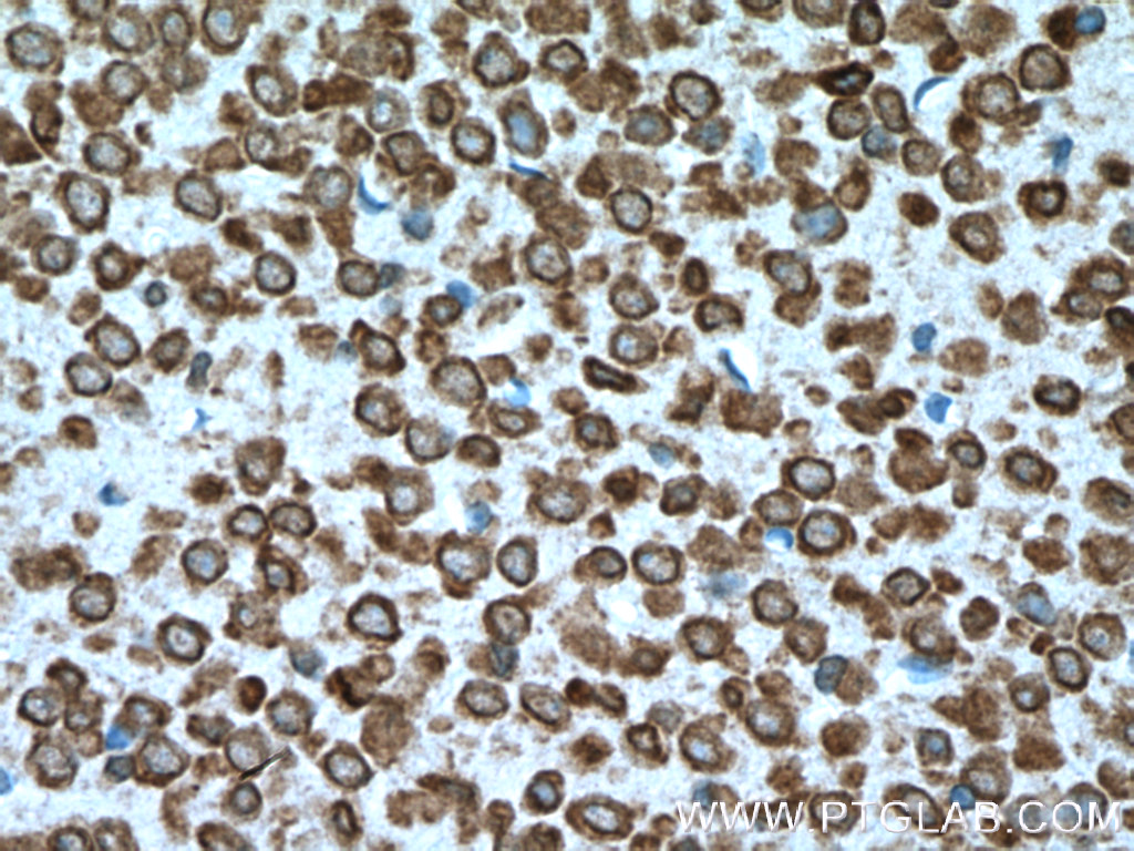 IHC staining of mouse brain using 66266-1-Ig
