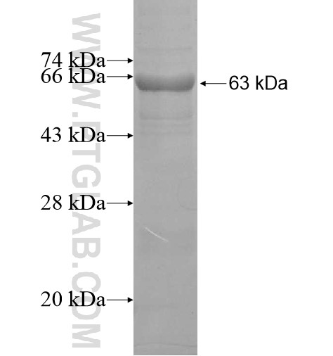 SRR fusion protein Ag12449 SDS-PAGE