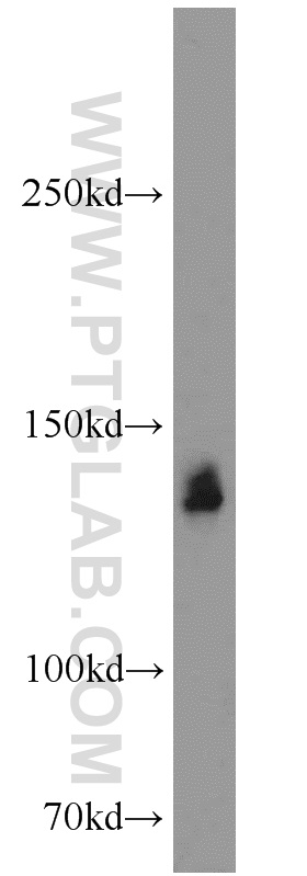 WB analysis of mouse liver using 12822-1-AP