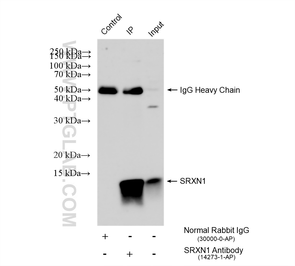 IP experiment of A549 using 14273-1-AP