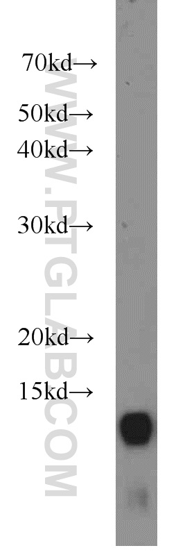 WB analysis of A549 using 14273-1-AP