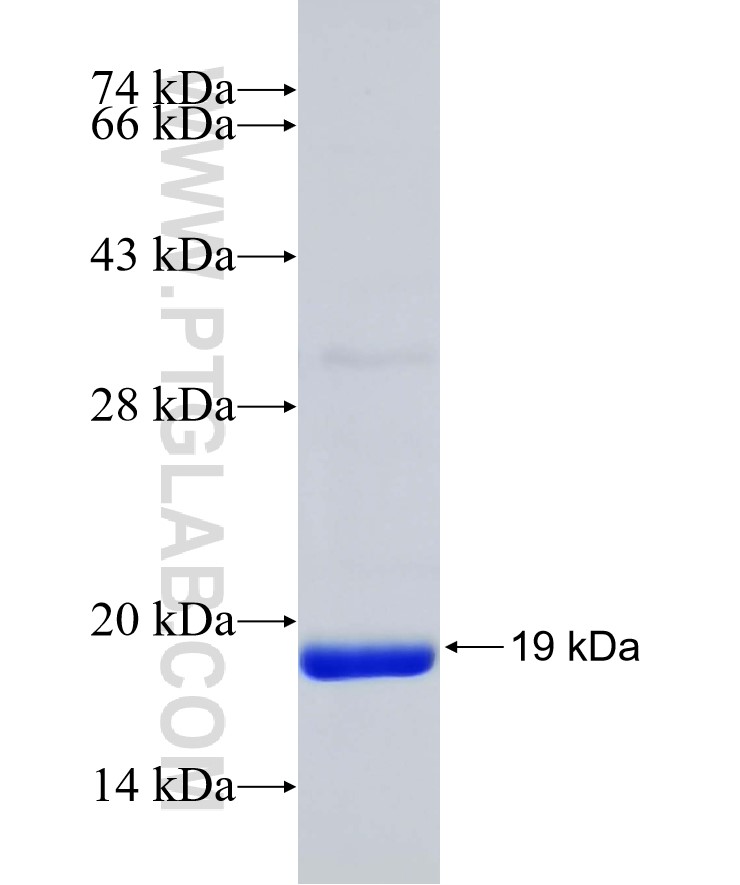 SRX1 fusion protein Ag31573 SDS-PAGE SRX1 fusion protein Ag31573 SDS-PAGE